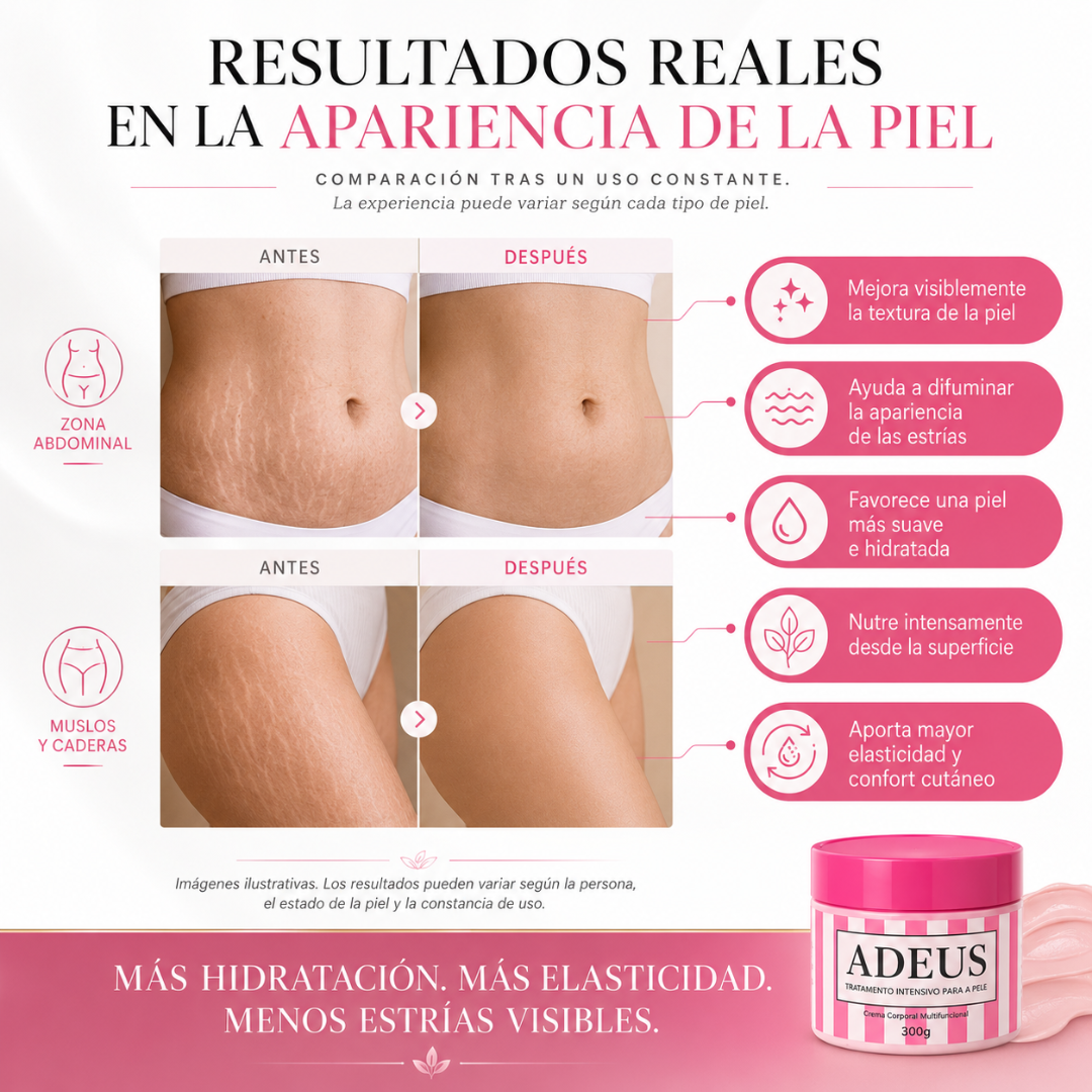 VELMARYS™ Crema Corporal Regeneradora Antiestrías