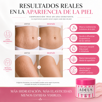 VELMARYS™ Crema Corporal Regeneradora Antiestrías