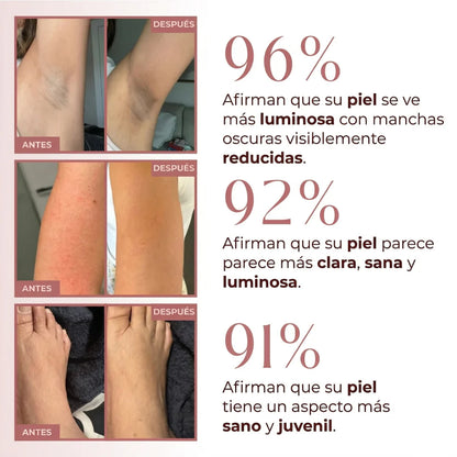 Exfoliante Corporal de Cúrcuma y Ácido Kójico - Piel Suave y Tono Uniforme - 250ml