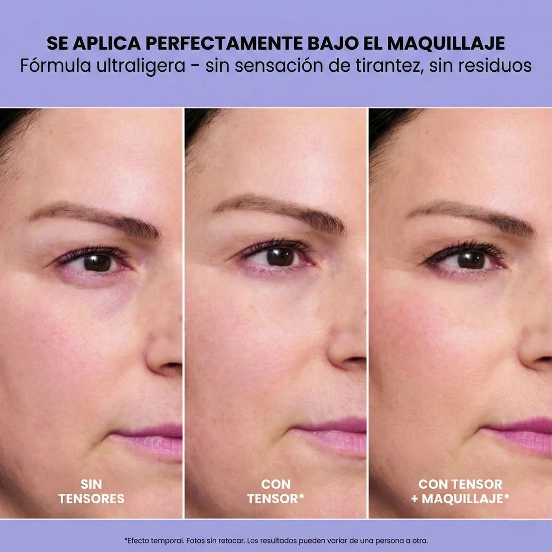 VelmarysLift – Gel tensor para bolsas y líneas de expresión