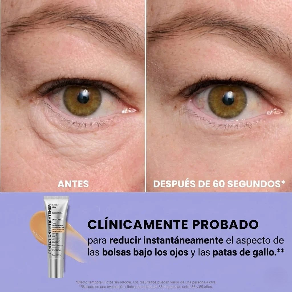 VelmarysLift – Gel tensor para bolsas y líneas de expresión
